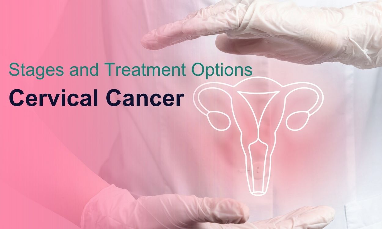 Cervical Cancer Stages and Treatment Options