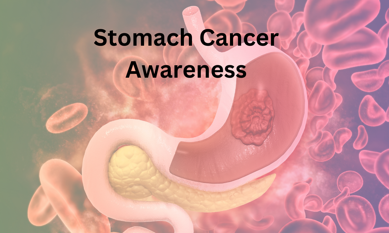 Understanding, Prevention, and Support on Stomach Cancer Awareness Day”