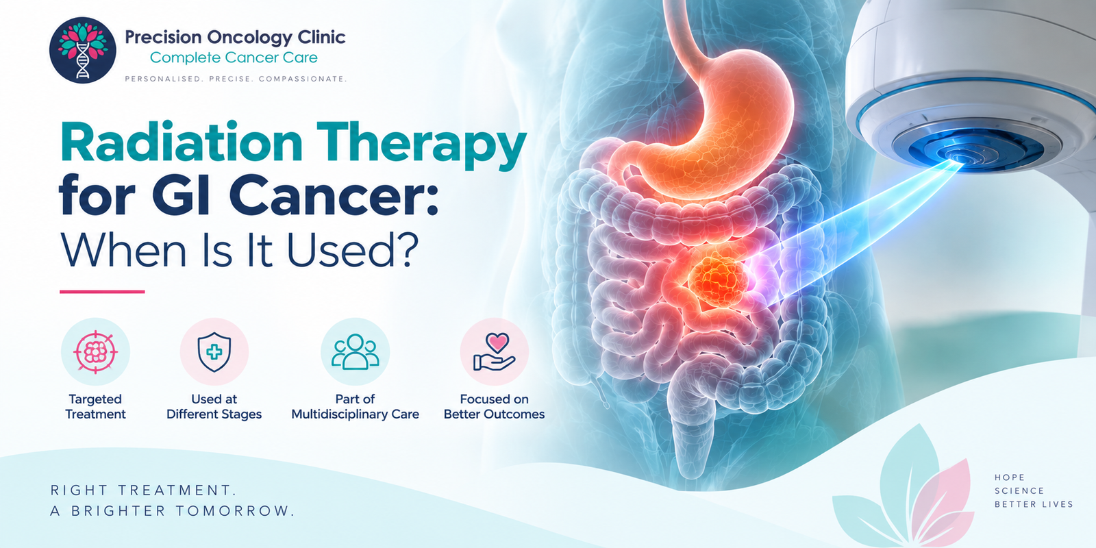 When Is Radiation Therapy Used for Gastrointestinal Cancer?